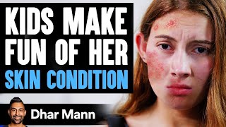 Kids MAKE FUN Of Girls SKIN CONDITION What Happens Is Shocking  Dhar Mann [upl. by Haas]