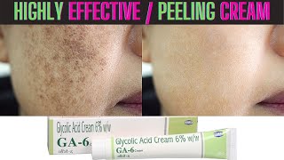 Glycolic Acid Peeling Cream  Highly Effective Result  Skin Whitening [upl. by Hurwit]