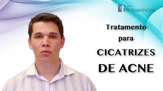 Como é o Tratamento para Cicatrizes de Acne com Laser de CO2 Fracionado [upl. by Eidak]