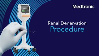 Radiofrequency Renal Denervation Procedure [upl. by Lali682]