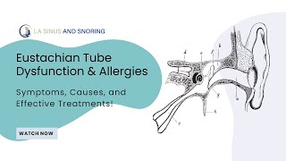 Eustachian Tube Dysfunction amp Allergies Symptoms Causes and Effective Treatments [upl. by Wennerholn]