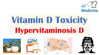 Vitamin D Toxicity Hypervitaminosis D  Causes Pathophysiology Symptoms Diagnosis Treatment [upl. by Hiram]