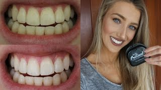 How I Whitened My Teeth At Home  Smile Brilliant Giveaway ♡ [upl. by Jerrilee649]