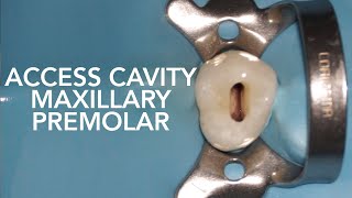 Pre Clinical Endodontic  Access Cavity of Maxillary Premolar [upl. by Orazal]