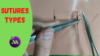 Common SUTURES techniques suture [upl. by Fredrika]