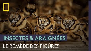 Se faire piquer par des abeilles pour guérir du syndrôme dEhlersDanlos [upl. by Analah]