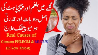 Real Causes of Constant PHLEGM amp MUCUS In Your Throat and Its Homeopathic Treatment [upl. by Tavi359]