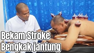 Stroke Dan Jantung Bengkak sembuh sekalian beberapa hari kemudian setelah Bekam [upl. by Hau]