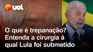 Lula faz cirurgia na cabeça presidente passa por trepanação para drenagem de hemorragia entenda [upl. by Morocco]