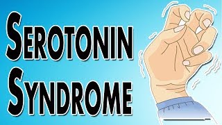 Managing Serotonin Syndrome [upl. by Airlee]