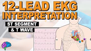 The ST Segment and T Wave REVIEW [upl. by Eckhardt713]