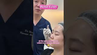 Where and How Fillers are Injected [upl. by Ru381]