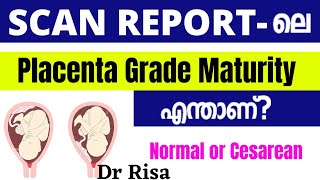 Placenta Grade in Scan Report Malayalam  Placenta Position [upl. by Eicrad]