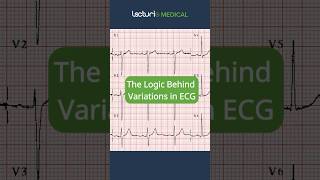 The Logic Behind Variations in ECG usmle usmleprep ecginterpretation [upl. by Kela]