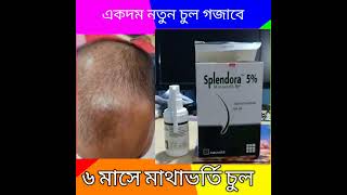 স্প্লেনডোরা মিনোক্সিডিল  Splendora Minoxidil Honest Review splendora Minoxidil review [upl. by Ettenan]