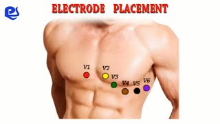 Proper ECG Leads Placement [upl. by Naegem]