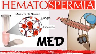 Hematospermia en menos de 2 minutos [upl. by Adler192]