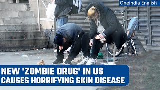 Xylazine Zombie drug causes menace in US as users get raw wounds on skin  Oneindia News [upl. by Aettam]