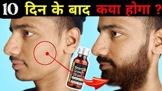 Ustraa Advanced Beard Growth Oil After 10 Days Review Best Beard Oil For Patchy Beard in India 2024 [upl. by Papp]