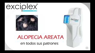 EXCIPLEX avances en su uso [upl. by Eelhsa]