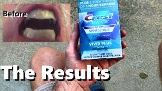 CREST Whitening Strips 3D BeforeAfter 12 Treatments Vivid Plus Teeth Enamel Cleaning 30 minutes [upl. by Burton]