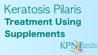 Keratosis Pilaris Treatment Using Supplements Video [upl. by Dorian]