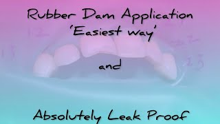 Rubber dam application in exact one and a half minutes [upl. by Holzman]