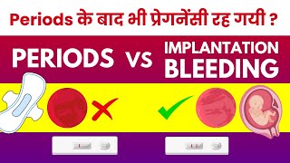 Implantation Bleeding vs Period Miscarriage  Kab Hoti Hai Kitne Din Baad Hoti Hai [upl. by Lezirg]