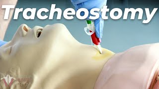 How to Perform a Tracheostomy [upl. by Libby807]