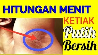 Cukup Hitungan Menit Untuk Memutihkan Ketiak dan Selangkangan Hitam [upl. by Assisi]