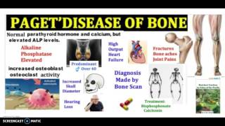 What is Pagets Disease of bone in 3 minutes Symptoms Pathophysiology and Treatment [upl. by Placida]