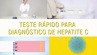 Teste Rápidos para diagnóstico da Hepatite C [upl. by Sandry]