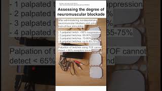 Assessing the degree of neuromuscular blockade [upl. by Euqram]