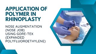 THE APPLICATION OF GORETEX IN RHINOPLASTY [upl. by Busiek]