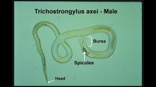 TrichoStrongylus  Species Life cycle Transmission Disease Symptoms Diagnosis Treatment [upl. by Tj668]