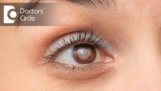 Which is the best Intraocular Lens suited for eyes Dr Samina F Zamindar [upl. by Circosta]