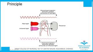 Basics to Pulseoximetry and Plethysmography [upl. by Illoh]