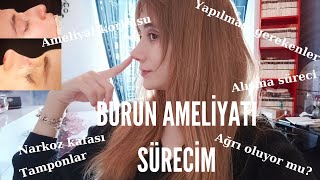 Burun Ameliyatı Sürecim Ağrı Fiyat Narkoz Tamponlar Ameliyat Sonrası [upl. by Aibat]