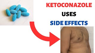 KETOCONAZOLE NIZORAL Uses Side effects Review Shampoo Cream Soap Lotion [upl. by Bandeen]