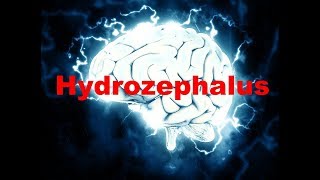 Hydrozephalus  Neurologie 4 [upl. by Gniw842]