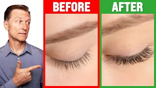 How to Grow Long Thick Eyelashes QUICKLY  Dr Berg [upl. by Ynhoj]