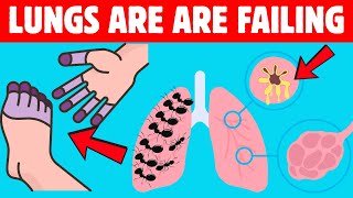 You Are Killing Your Lungs IF You Ignore These 15 Early Warnings Signs [upl. by Giraldo578]