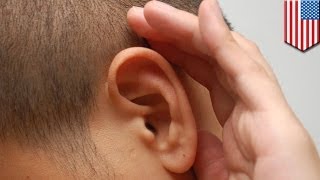 University of Kansas invents gene therapy to restore natural hearing [upl. by Orban]