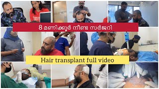 Hair Transplant Journey  La Densitae  Arjun Somasekhar  Sowbhagya Venkitesh [upl. by Moira]