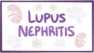 Lupus nephritis  causes symptoms diagnosis treatment pathology [upl. by Nyltak]