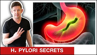 How To Stop H Pylori IN DAYS [upl. by Ilram581]