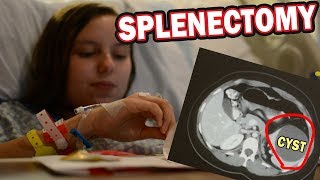 MY WIFES SPLENECTOMY  SPLEEN CYST [upl. by Outhe]