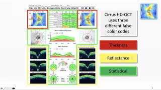 Optimizing OCT Usage In Glaucoma Management [upl. by Llemhar]