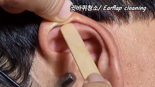 ASMR Real Series 귓바퀴청소 Earflap cleaning 耳介清掃 [upl. by Htennek447]