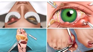 ASMR Removal acne and Eye Remove armpit Face amp tick from face Worm remove asmr asmrvideo asmr [upl. by Isadora358]